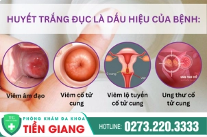 hien-tuong-ra-nhieu-khi-hu-mau-trang-duc-nhu-ba-dau-136