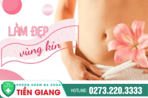 nhung-cach-lam-dep-vung-kin-531