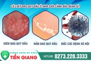 lo-loet-bao-quy-dau-nam-gioi-bao-hieu-cua-benh-nguy-hiem-o-nam-335