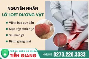 lo-loet-duong-vat-hinh-anh-nguyen-nhan-dau-hieu-442
