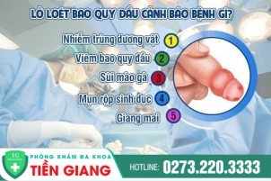 loet-bao-quy-dau-va-benh-nguy-hiem-neu-chua-chua-tri-kip-thoi-49