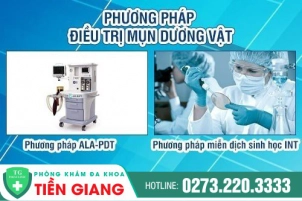 cau-nho-bi-noi-mun-cach-dieu-tri-nhanh-chong-568