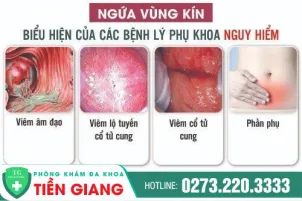 ngua-vung-kin-o-nu-co-anh-huong-den-suc-khoe-khong-137
