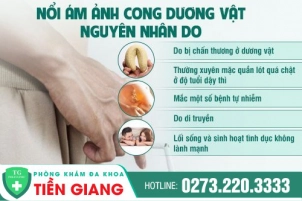 tai-sao-duong-vat-nam-gioi-bi-cong-bien-phap-cai-thien-la-gi-446