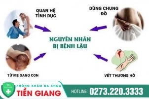 nguyen-nhan-dan-den-benh-lau-cach-dieu-tri-357