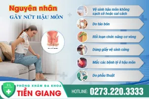 nut-hau-mon-nguyen-nhan-phuong-phap-dieu-tri-chi-phi-909