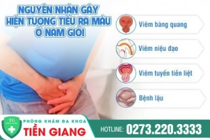 nguyen-nhan-tieu-ra-mau-o-nam-va-cach-chua-tri-hieu-qua-161