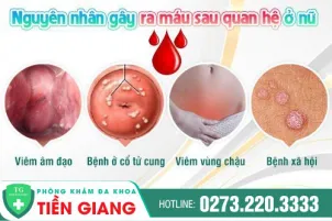 ra-mau-khi-quan-he-co-dang-lo-ngai-khong-521