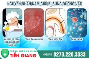 cac-ly-do-gay-sung-duong-vat-canh-may-rau-can-biet-440