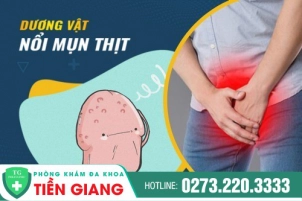 noi-mun-thit-la-o-duong-vat-chu-y-khong-nen-bo-qua-497