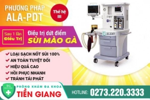 phuong-phap-dieu-tri-sui-mao-ga-hien-dai-moi-381