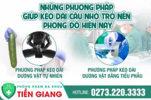 phuong-phap-keo-dai-duong-vat-va-chi-phi-584
