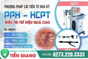 top-cac-phuong-phap-cat-tri-tot-hien-nay-52