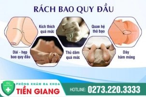 rach-bao-quy-dau-o-nam-gioi-va-cac-cach-khac-phuc-388