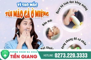 sui-mao-ga-o-mieng-bieu-hien-som-cua-sui-mao-ga-173
