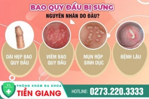 sung-bao-quy-dau-do-dau-va-tri-bang-cach-nao-714