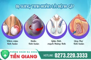 tinh-hoan-bi-sung-ly-do-va-cach-xu-ly-129