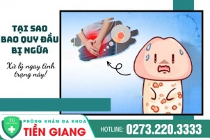 tai-sao-bao-quy-dau-bi-ngua-xu-ly-ngay-tinh-trang-nay-392