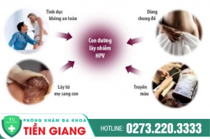 sui-mao-ga-co-lay-khong-lay-bang-duong-nao-100