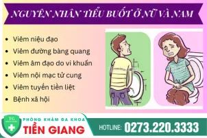 cac-nguyen-nhan-tieu-buot-o-nu-lan-nam-48