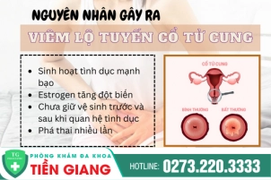 nhung-dieu-can-biet-ve-viem-lo-tuyen-tu-cung-102