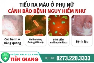 tieu-ra-mau-la-benh-gi-nhan-biet-som-chua-tri-kip-thoi-162