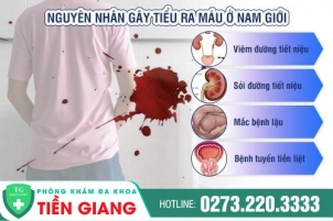 di-tieu-ra-mau-va-cac-benh-pho-bien-301