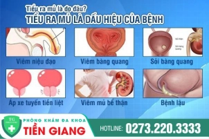 di-tieu-ra-mu-la-dau-hieu-cua-benh-gi-nguyen-nhan-va-cach-chua-tri-hieu-qua-91
