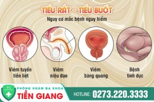 tieu-rat-tieu-buot-nguyen-nhan-va-cach-chua-tri-hieu-qua-89