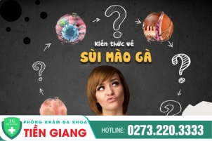 sui-mao-ga-o-nu-gioi-168