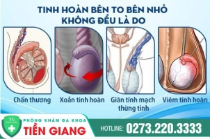 tai-sao-tinh-hoan-1-ben-to-1-ben-nho-dieu-tri-nhu-the-nao-71