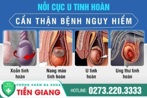 tinh-hoan-noi-cuc-dau-hieu-benh-ly-nguy-hiem-nen-kham-va-dieu-tri-ngay-566