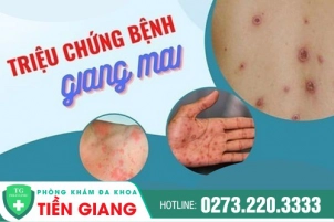 nhan-biet-cac-trieu-chung-benh-giang-mai-qua-bai-viet-sau-156
