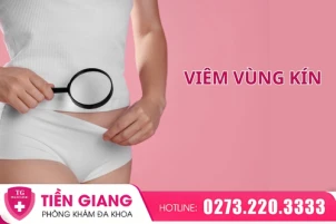 canh-bao-viem-vung-kin-dung-chu-quan-voi-suc-khoe-phu-khoa-1432