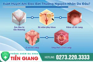 xuat-huyet-am-dao-bat-thuong-nguyen-nhan-do-dau-835