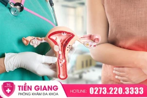 viem-vung-kin-nhan-biet-som-dieu-tri-dung-ngua-tai-nhiem-benh-1434