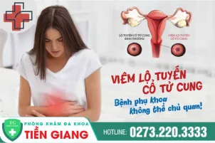 lo-tuyen-co-tu-cung-la-gi-dau-hieu-nhan-biet-va-cach-dieu-tri-1149