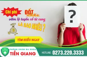 chi-phi-dot-viem-lo-tuyen-co-tu-cung-het-bao-nhieu-1166