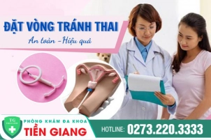 uu-nhuoc-diem-cua-vong-tranh-thai-ma-chi-em-nen-biet-1158