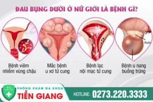 dau-bung-duoi-dau-hieu-benh-ly-gi-khac-phuc-nhu-the-nao-767