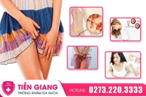 5-trieu-chung-benh-am-dao-thuong-gap-va-cach-xu-ly-an-toan-1445