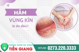ham-vung-kin-o-nu-nguyen-nhan-va-cach-tri-1230