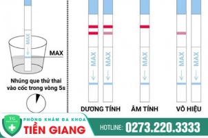 phong-kham-phu-khoa-tien-giang-su-dung-que-thu-thai-nhu-the-nao-moi-dung-1379