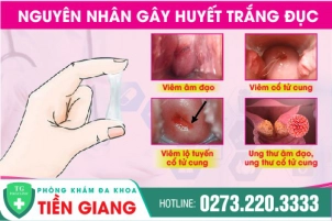 nguyen-nhan-gay-huyet-trang-duc-dau-hieu-benh-ly-va-cach-dieu-tri-1225
