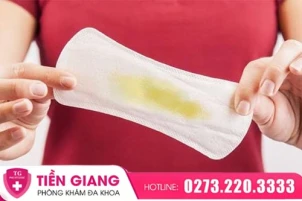 khi-hu-mau-vang-la-bi-gi-va-nhung-dieu-chi-em-can-luu-y-1406