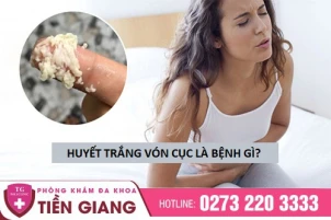 huyet-trang-von-cuc-la-dau-hieu-cua-benh-gi-1405