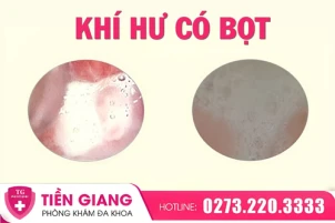 khi-hu-bot-la-gi-nguyen-nhan-va-cach-dieu-tri-hieu-qua-1491