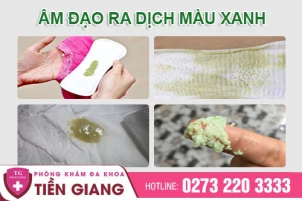khi-hu-mau-xanh-dau-hieu-viem-nhiem-phu-khoa-khong-the-bo-qua-1477