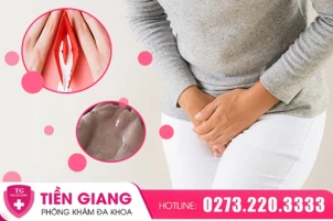 ra-nhieu-khi-hu-co-anh-huong-nguy-hiem-gi-khong-459