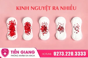 kinh-nguyet-ra-nhieu-ngay-co-nen-lo-lang-khong-cach-cai-thien-hieu-qua-1114